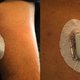Bluetooth-enabled blood-glucose monitoring via a tiny needle under the skin.